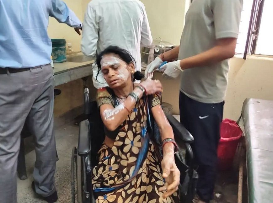 कौशाम्बी: चाय बनाते समय रसोई में फटा सिलेंडर, महिला गंभीर रूप से झुलसी